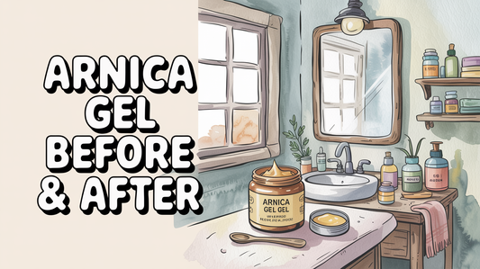 Arnica under eyes before and after