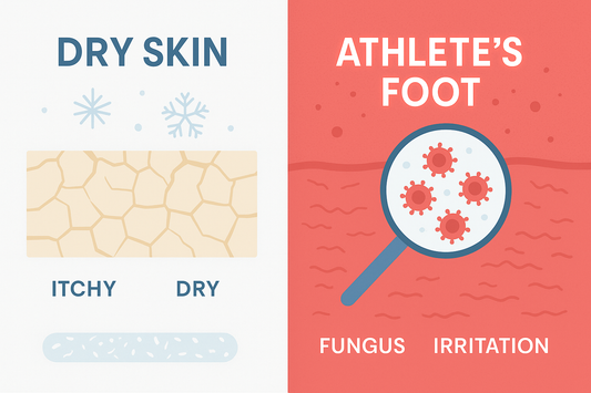 Is It Athlete’s Foot or Just Dry Skin? How to Tell the Difference