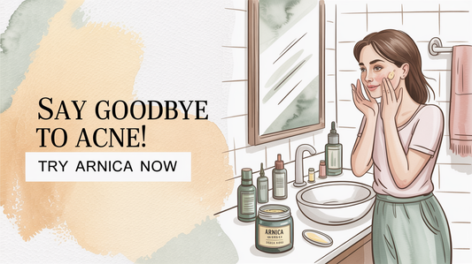 Is arnica good for acne?